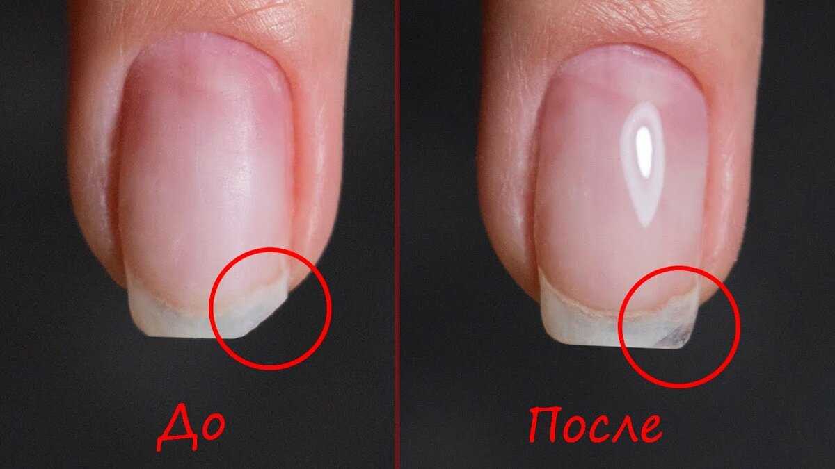 Как исправить трещину на ногте: 10 шагов